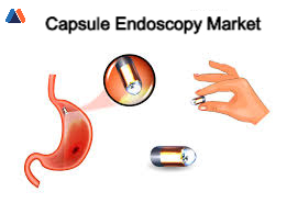 Capsule Endoscopy Market.jpg